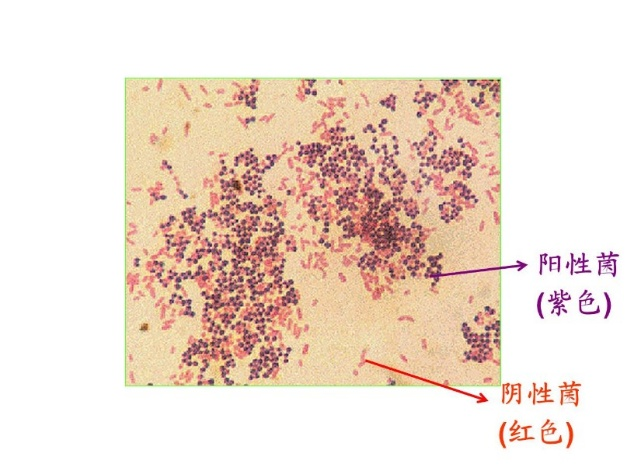 革兰氏染色法的建立